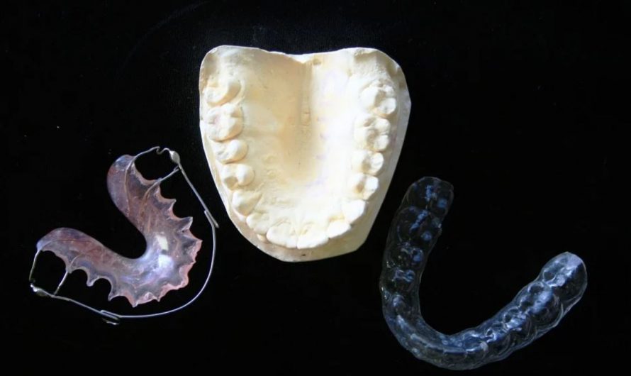 12 Significados de Soñar con Aparatos de Ortodoncia