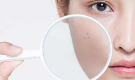 ¿Qué significa soñar con manchas de la edad? 5 significados simbólicos