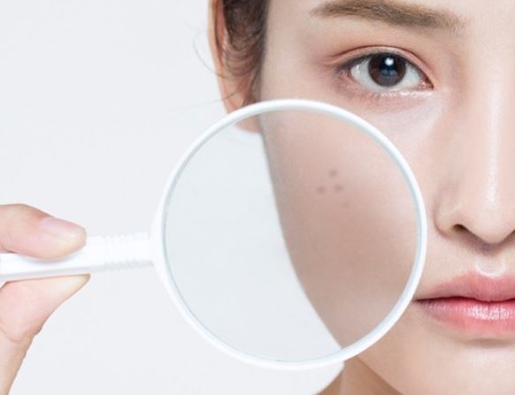 ¿Qué significa soñar con manchas de la edad? 5 significados simbólicos