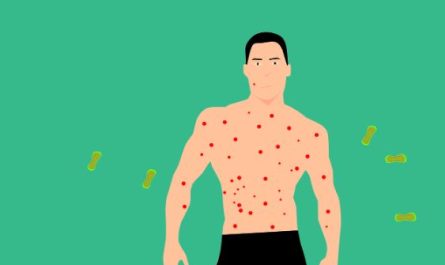 ¿Qué significa soñar con varicela?