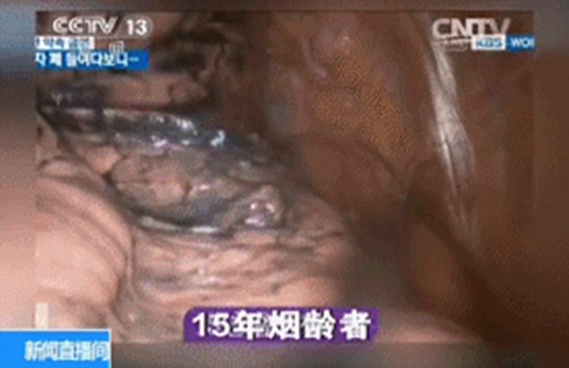 吸煙如何影響肺部？